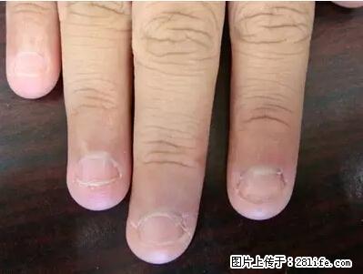 剪指甲、挖耳屎，这些日常小动作竟隐藏大危害！ - 甘南生活资讯 - 甘南28生活网 gn.28life.net